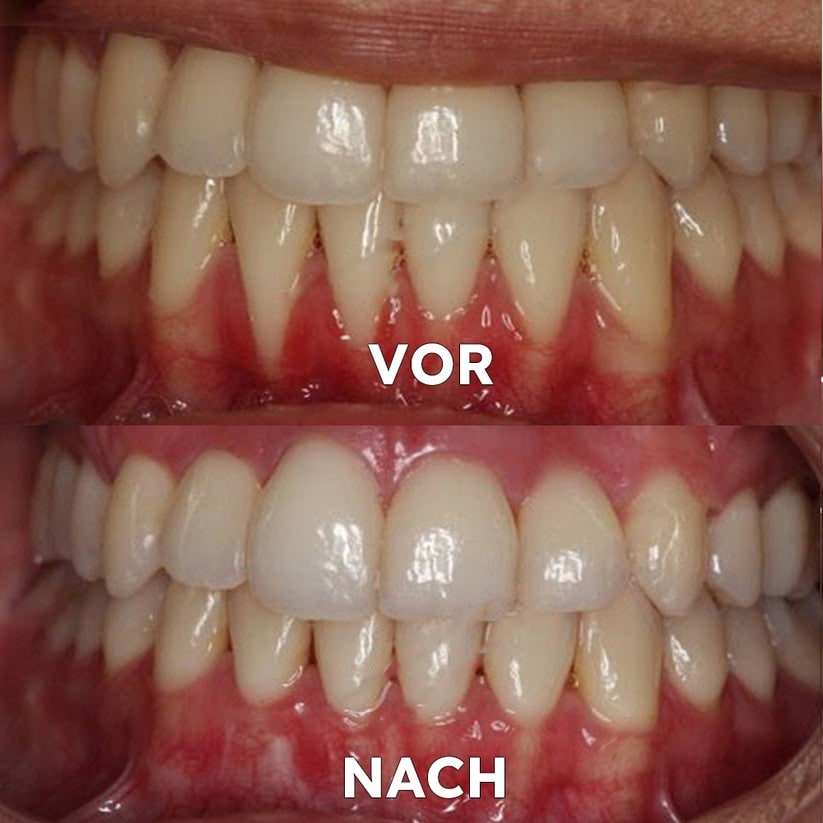 Mineralpulver für Zahnpflege | Zähne Stärken & Schützen | SmileSchutz