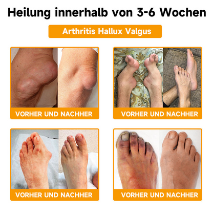 Bienengiftcreme | Salbe mit Bienengift, Hyaluron & Kollagen | BeeLixir