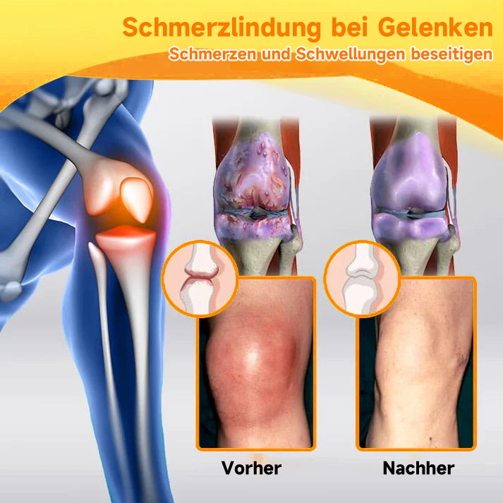 Bienengiftcreme | Salbe mit Bienengift, Hyaluron & Kollagen | BeeLixir