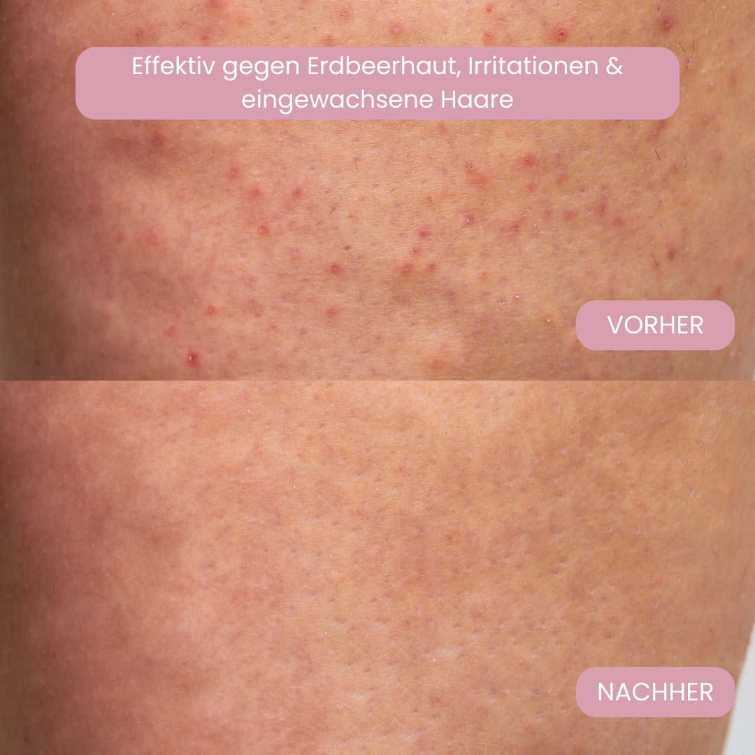 Intimrasierer für Frauen | Elektrischer Damenrasierer für Intimbereich | Bikini Trimmer | Femora