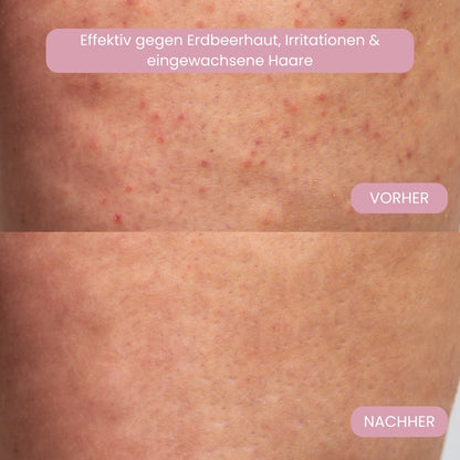Intimrasierer für Frauen | Elektrischer Damenrasierer für Intimbereich | Bikini Trimmer | Femora