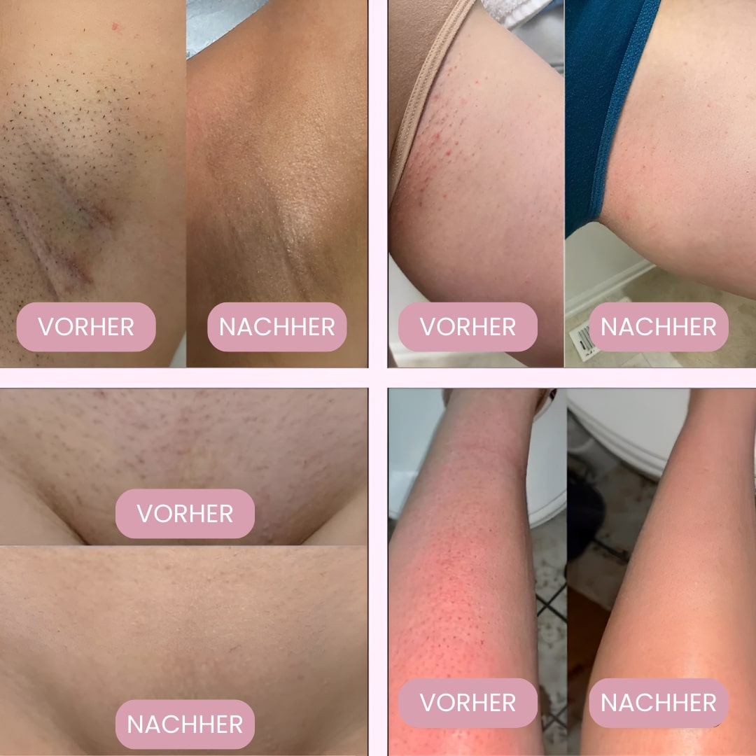 Intimrasierer für Frauen | Elektrischer Damenrasierer für Intimbereich | Bikini Trimmer | Femora