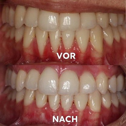 Mineralpulver für Zahnpflege | Zähne Stärken & Schützen | SmileSchutz